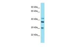 Striatin Rabbit anti-Mouse, Polyclonal, Novus Biologicals 0.1 mL | Buy Online | Novus Biologicals | Fisher Scientific
